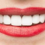 promocion limpieza y blanqueamiento por navidad